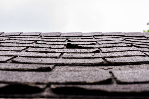 Blistering Shingles- Here’s What You Need to Know!
